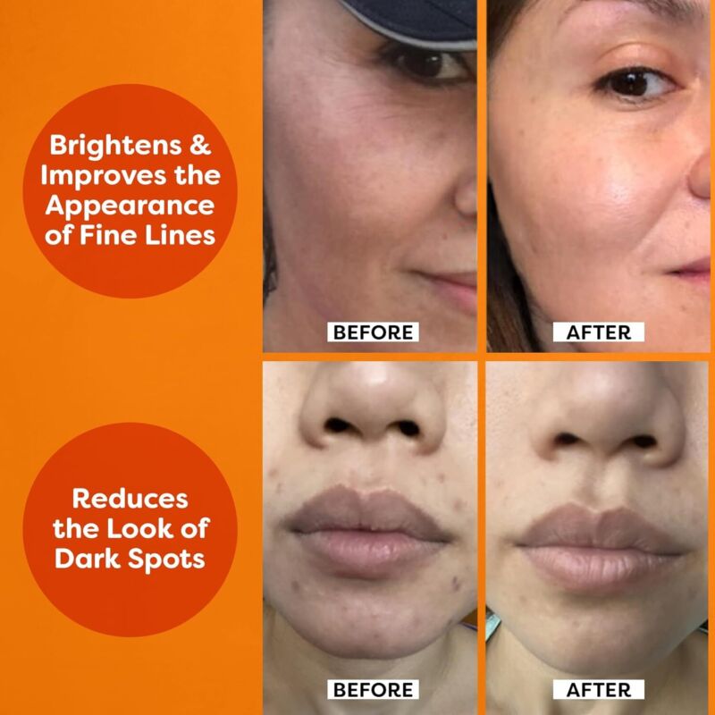 TruSkin Vitamin C Serum For Face – Anti Aging Formula with Vitamin C, Hyaluronic Acid, Vitamin E – Brightening Serum – Improve Appearance of Dark Spots, Tone, Fine Lines & Wrinkles, 1 Fl Oz : Beauty & Personal Care