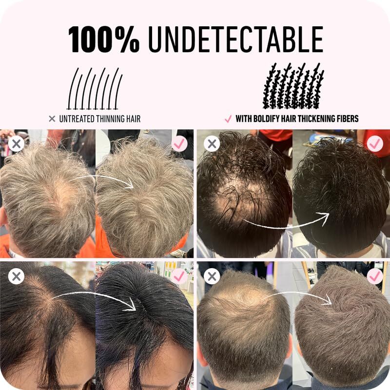BOLDIFY Hair Fibers (28g) - Fill In Thinning and Fine Hair for an Instantly Fuller, Thicker Look - 14 Shades for Women & Men - Dark Brown : Beauty & Personal Care