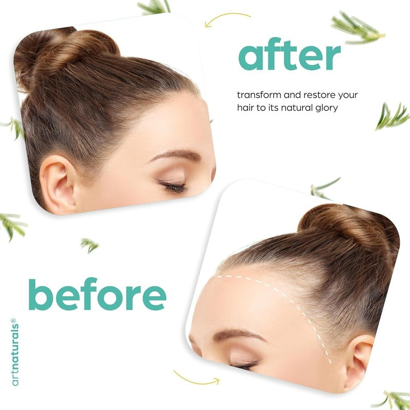 ArtNaturals Organic Rosemary & Castor Hair Growth Oil + Scalp Massager Set – Hair Styling Oils for Dry, Itchy Scalp, Thickening & Hydration - Scalp Oil Products For Damaged Hair & Split Ends – 4.0 oz : Beauty & Personal Care