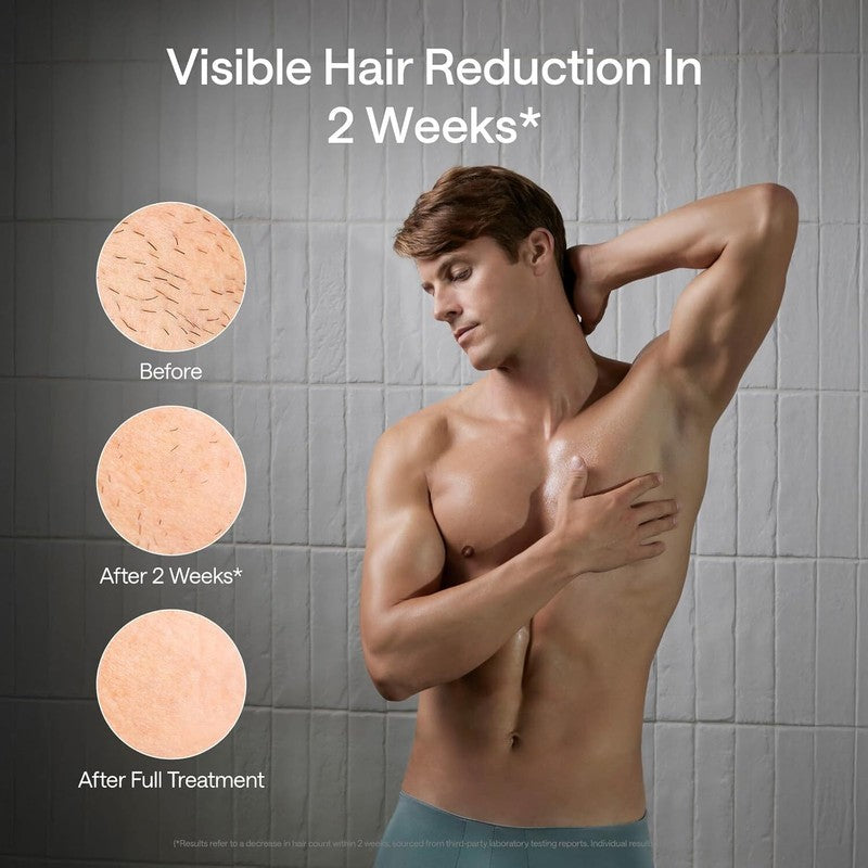 Ulike Laser Hair Removal for Men, Ulike X Plug-in IPL Hair Removal with Ice-Cooling, Dual Lights & Skin Senor for Nearly Painless & Long-Lasting Hair Removal, 3 Modes Tailored for Men’s Stubborn Hair : Beauty & Personal Care