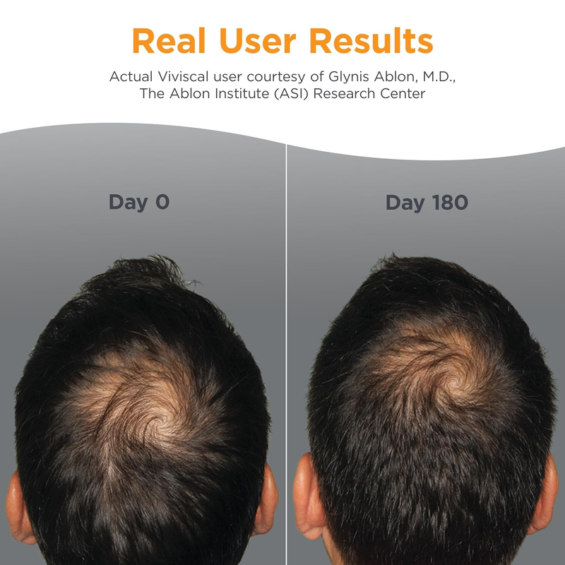 Viviscal Men's Hair Growth Supplements for Thicker, Fuller Hair Clinically Proven with Proprietary Collagen Complex, 60 Tablets - 1 Month Supply : Beauty & Personal Care