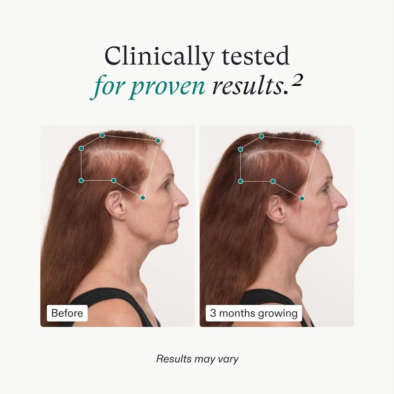 Nutrafol Women's Balance Hair Growth Supplements, Ages 45 and Up, Clinically Proven for Visibly Thicker Hair and Scalp Coverage, Dermatologist Recommended - 1 Month Supply : Beauty & Personal Care