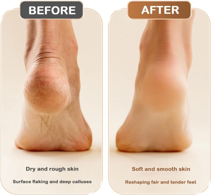 Electric Foot File Callus Remover Rechargeable Pedicure Kit for Men Women Black